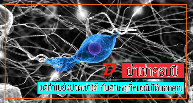 ผ่าเข่าครบปี  แต่ทำไมยังเจ็บที่เข่าอยู่  ทั้งที่แผลหายแล้วได้ละ