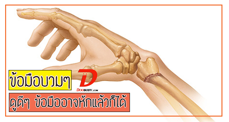 หักแน่ๆ  หากใช้มือยันพื้นตอนล้ม  กับวิธีการดูแลตนเองขณะใส่เฝือก
