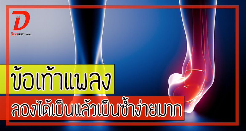ข้อเท้าแพลง  ลองได้เป็นแล้วจะเป็นซํ้าง่ายมาก