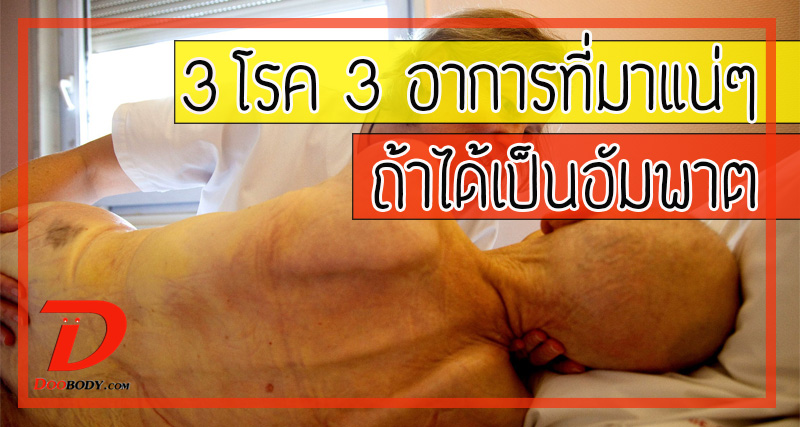 3 โรค 3 อาการ ที่มาพร้อมโรคอัมพาต