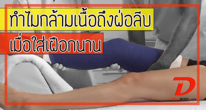 ทำไมกล้ามเนื้อฝ่อลีบ  หลังจากใส่เฝือกนาน  คำถามนี้เรามีคำตอบ
