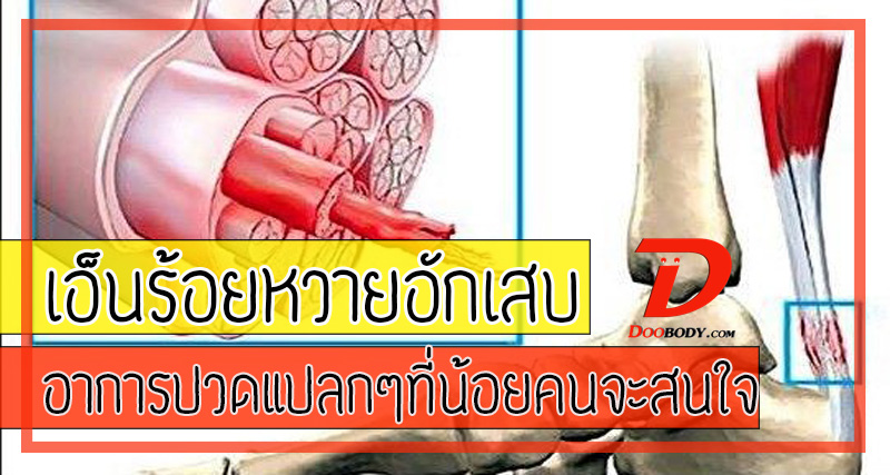 เอ็นร้อยหวายอักเสบ  อาการปวดแปลกๆที่น้อยคนจะสนใจ