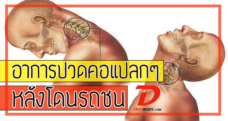 อาการปวดคอแปลกๆ หลังโดนรถชน