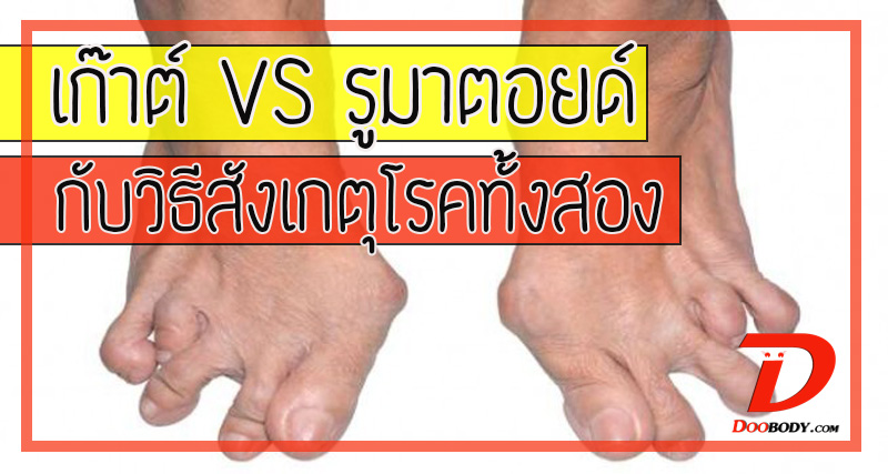เกาต์ VS รูมาตอยด์ ปวดข้อเหมือนกัน แต่มีรูปแบบการปวดที่ต่างกัน