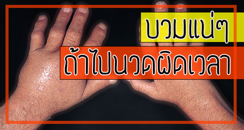 ปวด บวม แดง ร้อน หากมี 4 อาการนี้ อย่านวด!!  ถ้าไม่อยากให้เนื้อบวมเป็นลูกโป่ง