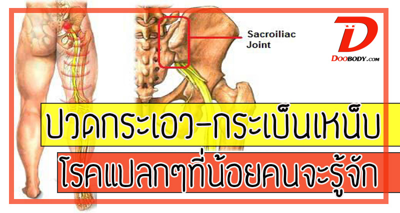 ปวดเอว ปวดกระเบนเหน็บ กับโรคแปลกๆที่คนเป็นเยอะ แต่รู้จักน้อย