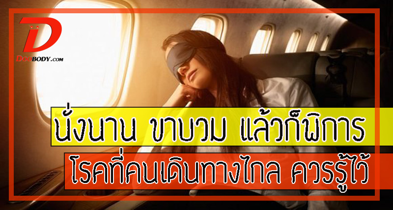 นั่งเครื่องบิน  เท้าบวม  แล้วก็พิการ  กับโรคที่คนเดินทางไกลควรรู้จัก