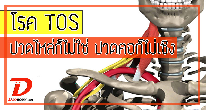 โรค TOS ปวดไหล่ก็ไม่ใช่ ปวดคอก็ไม่เชิง