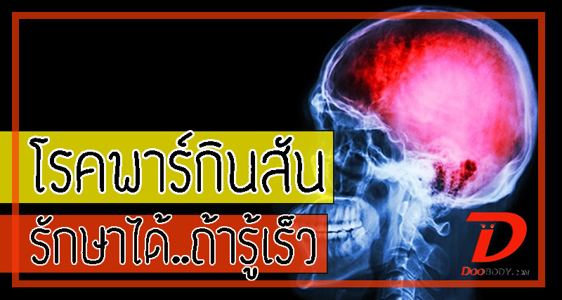 โรคพาร์กินสัน  อาการสั่นๆหยุดๆที่ควบคุมไม่ได้  แต่รักษาได้ถ้ารู้ตัวเร็ว