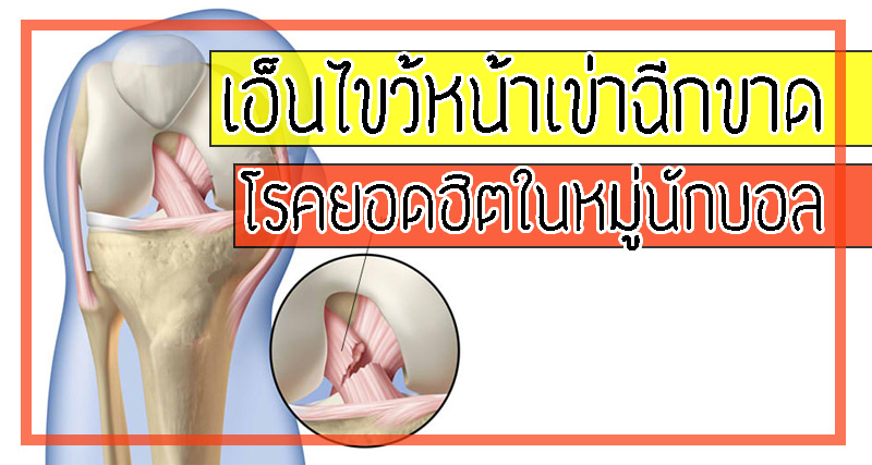 เอ็นไขว้หน้าเข่าฉีกขาด โรคยอดฮิตในหมู่นักบอล