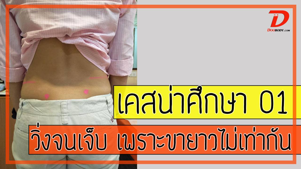 เคสน่าศึกษา 01  วิ่งจนเจ็บ เพราะขาสั้นยาวไม่เท่ากัน (แบบหลอกๆ)
