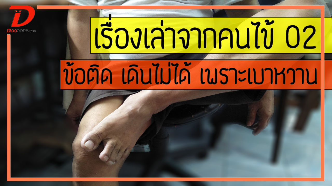 เรื่องเล่าจากคนไข้ 2 : ข้อติด เดินไม่ได้ และพิการ เพราะเบาหวาน