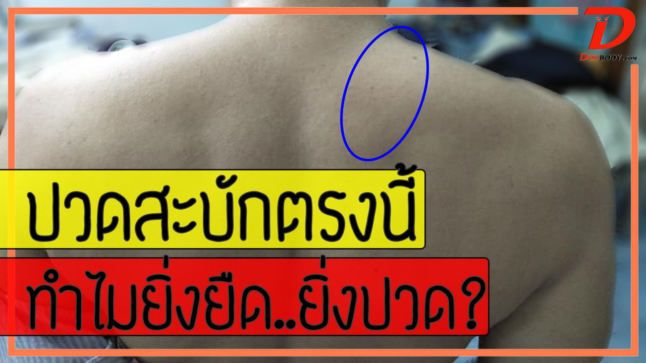 ปวดปีกสะบัดตรงนี้ ยืดเท่าไหร่ก็ไม่หาย นวดก็ไม่คลาย เป็นเพราะอะไร?