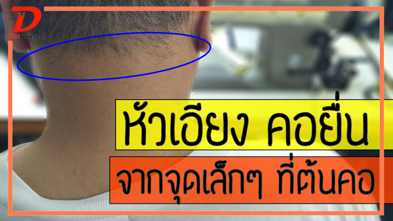 ปวดท้ายทอย มึนหัว หนักหัว เริ่มจากจุดเล็กๆที่ต้นคอ