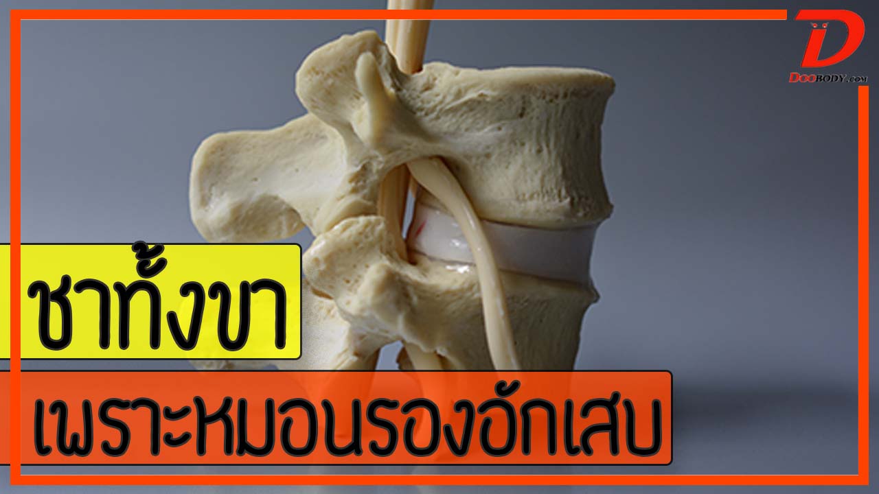 หมอนรองกระดูกสันหลังอักเสบ  ก็ทำให้ขาชาได้นะ