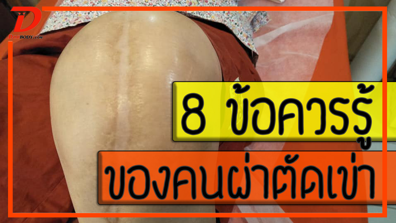 8 ข้อควรรู้  ของคนผ่าเข่าทุกประเภท